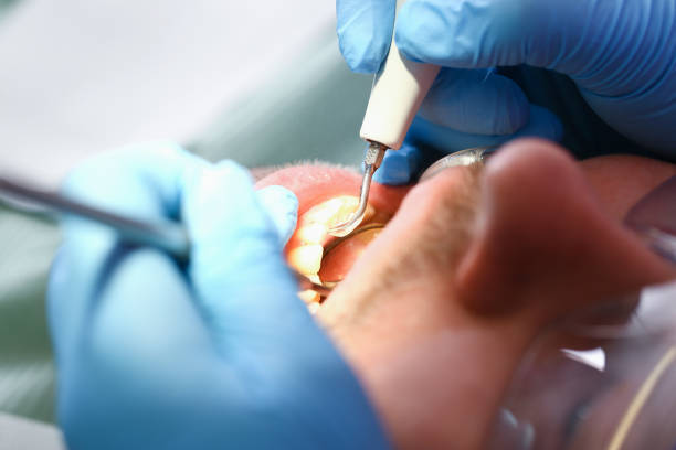 Best Cracked Tooth Emergency Dentist  in Mino Tassajara, CA